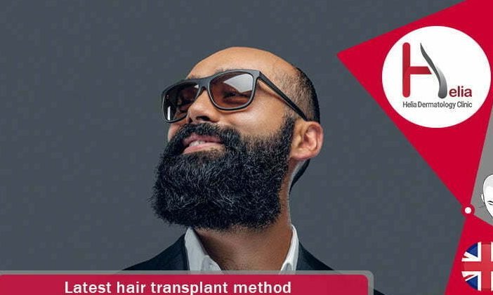 new advances in hair transplantation technology