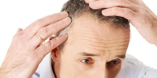 the benefits of hair transplant a guide to a new you