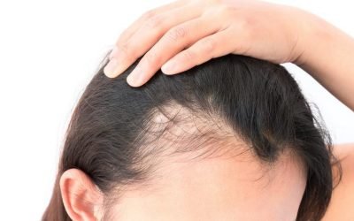 the benefits of hair transplant procedure