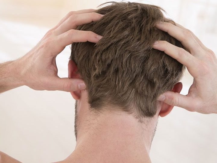 understanding hair loss and the effects of hair transplant